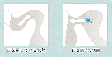 音がする状態の図