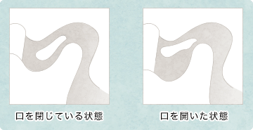 口が開かない状態の図