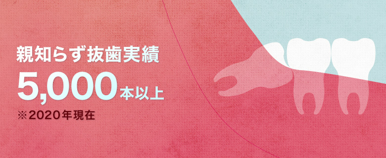 親知らず抜歯実績 5,000本以上※2020年現在