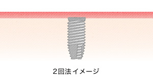 2回法イメージ