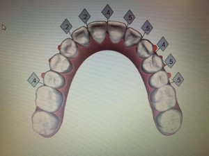 矯正終了時のシュミレーション画像