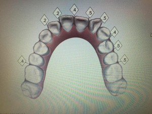 初回のシュミレーション画像