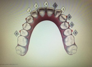 20枚目のシュミレーション画像