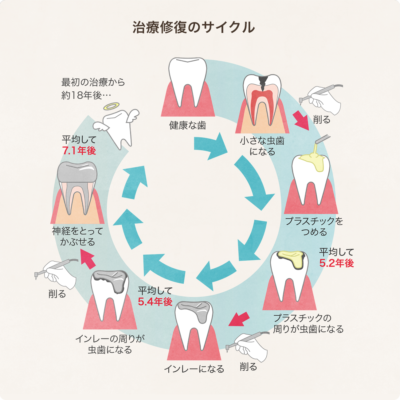 治療修復のサイクル図