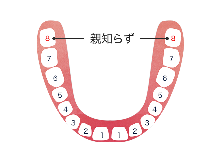 親知らずのイラスト