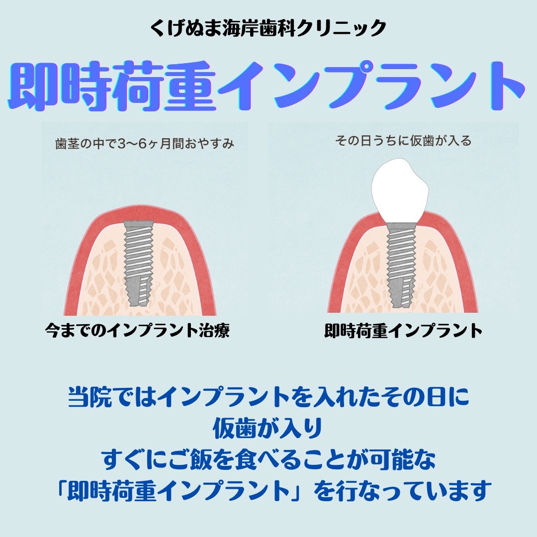 すぐに仮歯が入る！？即時荷重インプラント！ - スタッフブログ - 藤沢