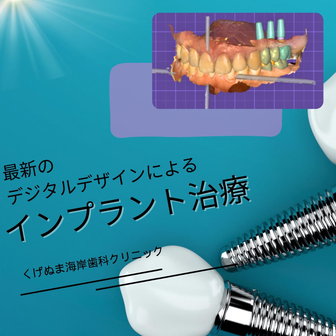 最先端！インプラントの3Dシュミレーション！ - スタッフブログ