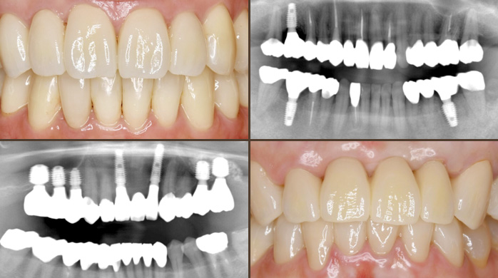 full_mouth_banner