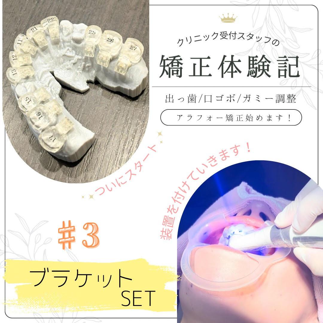クリニック受付スタッフの矯正体験記♯3🦷✨ - スタッフブログ - 藤沢