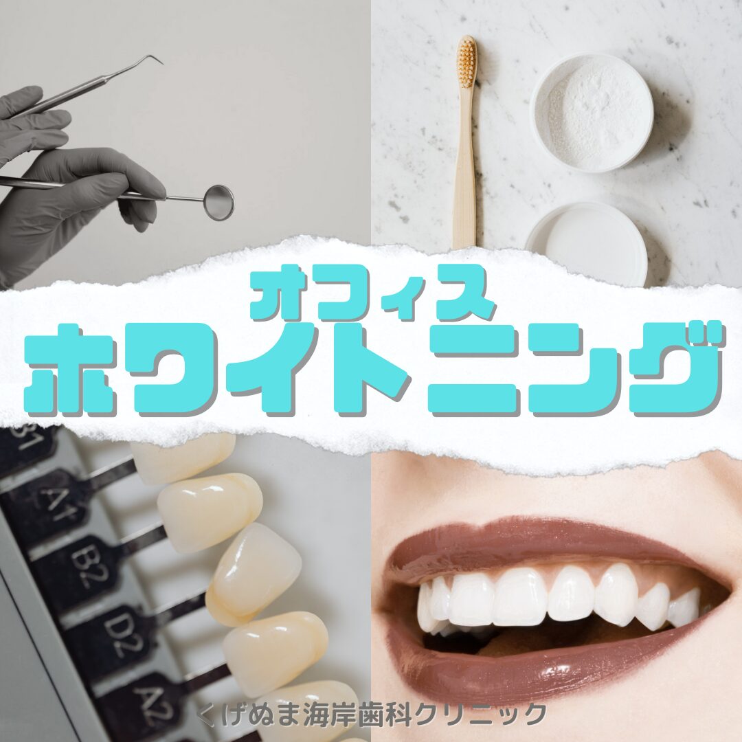 値下げ  二個 海外セレブも使用 歯のホワイトニング a45a0bd5441e873d79adaaa094cc07