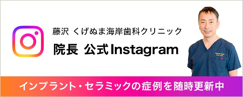 藤沢 くげぬま海岸歯科クリニック院長公式Instagram インプラント・セラミックの症例を随時更新中