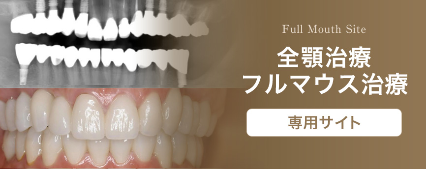 全顎治療フルマウス治療専用サイト