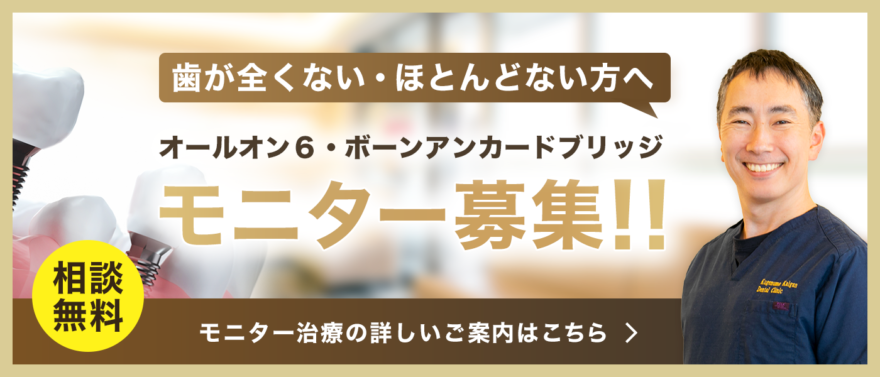 歯が全くない・ほとんどない方へ オールオン6・ボーンアンカードブリッジモニター募集!! 相談無料